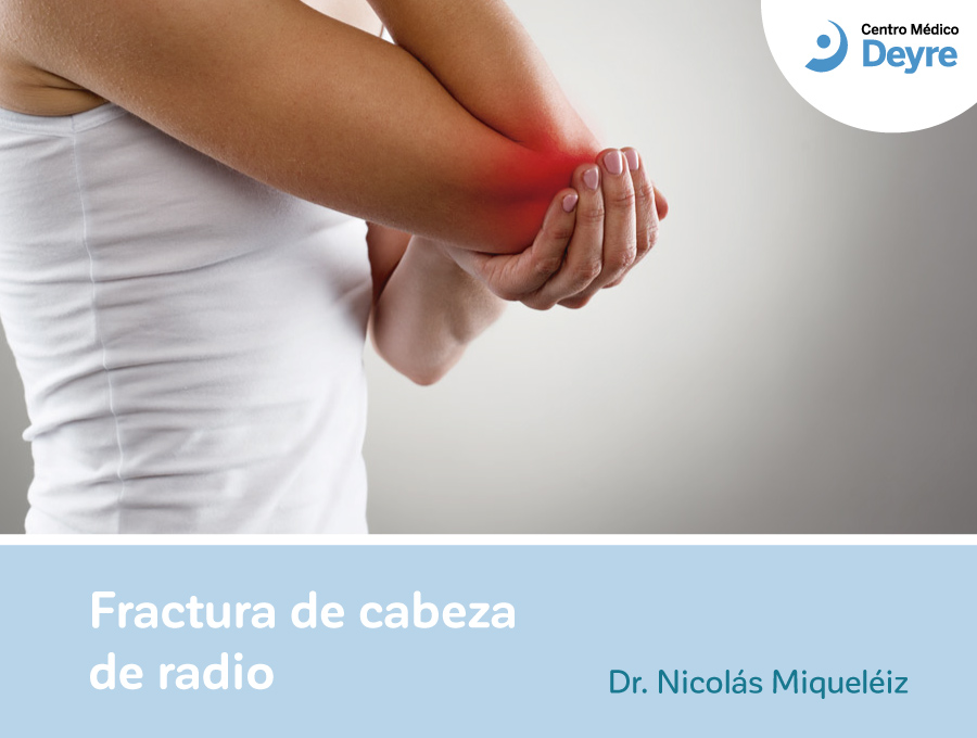 Fractura Cabeza de radio