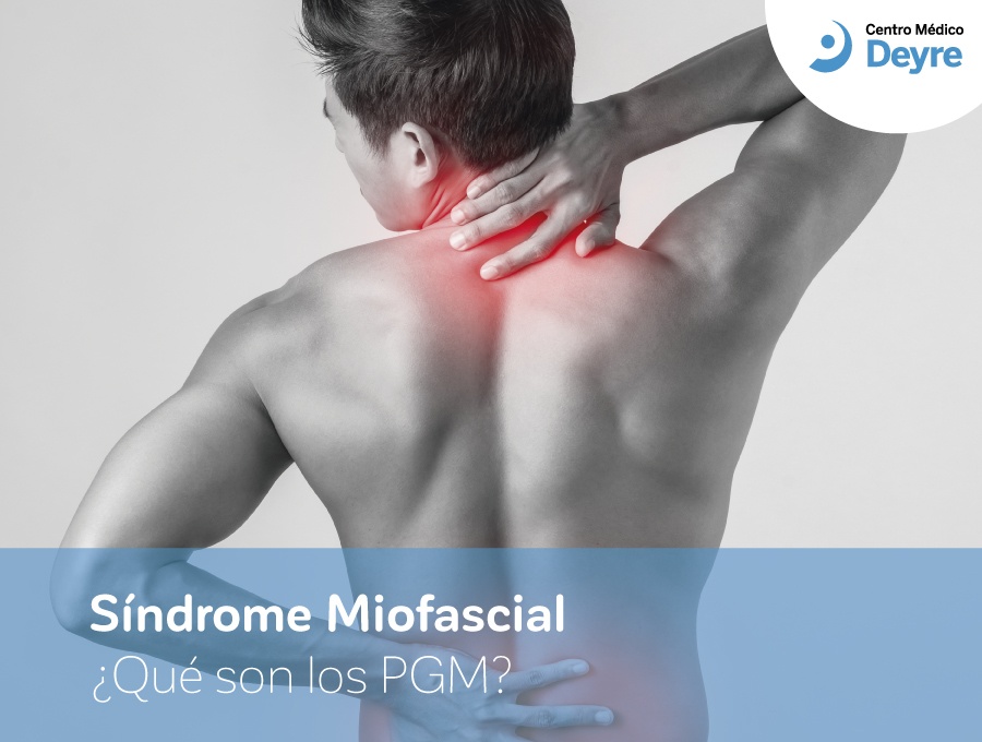 Sindrome miofascial